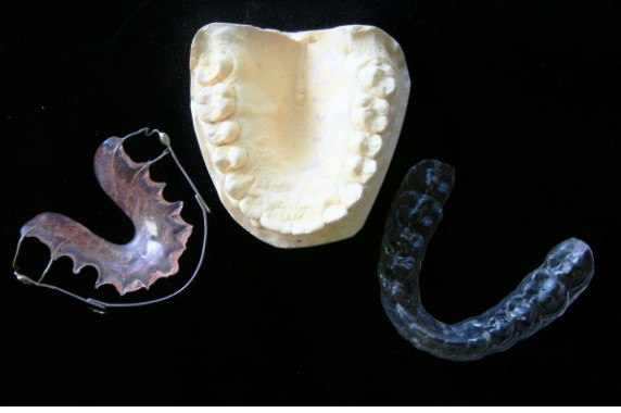 retenedores dentales removibles